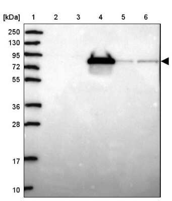 Western Blot: Coagulation Factor II/Thrombin Antibody [NBP2-33617]