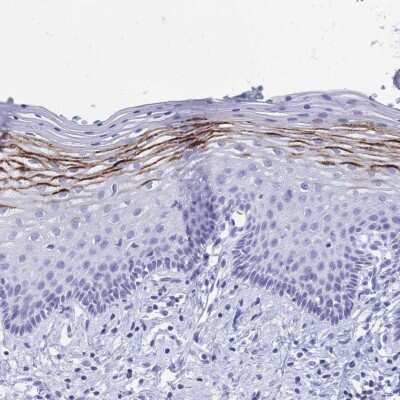 Immunohistochemistry-Paraffin: FA2H Antibody [NBP2-37957]