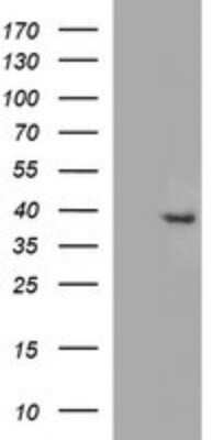 Western Blot: FA2H Antibody (OTI2E3)Azide and BSA Free [NBP2-72192]