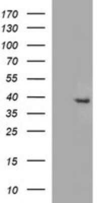 Western Blot: FA2H Antibody (OTI2E3) [NBP2-45564]