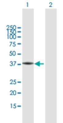 Western Blot: FA2H Antibody [H00079152-B01P]