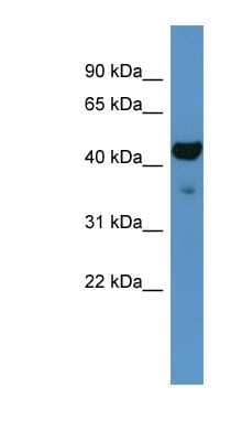 Western Blot: FA2H Antibody [NBP1-68928]