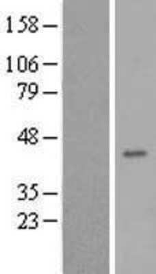 Western Blot: FA2H Overexpression Lysate [NBL1-10415]