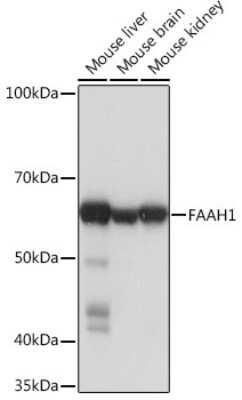 Western Blot: FAAH Antibody (10A1M7) [NBP3-16330]