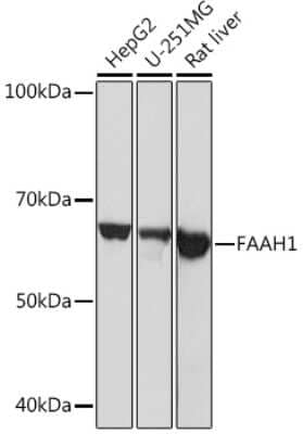 Western Blot: FAAH Antibody (10A1M7) [NBP3-16330]