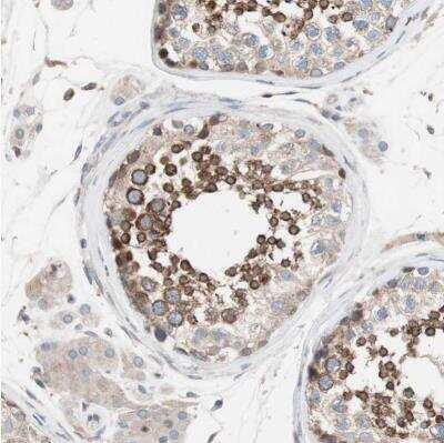 Immunohistochemistry-Paraffin: FAAH Antibody [NBP1-83937]