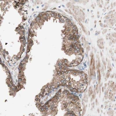 Immunohistochemistry-Paraffin: FAAH Antibody [NBP1-83937]