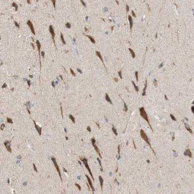Immunohistochemistry-Paraffin: FAAH Antibody [NBP1-83937]