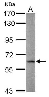 Western Blot: FAAH Antibody [NBP2-16397]