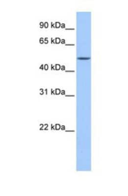 Western Blot: FAAH2 Antibody [NBP1-69705]