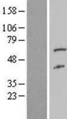 Western Blot: FAAH2 Overexpression Lysate [NBL1-10416]