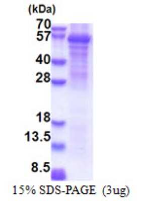 SDS-PAGE: Recombinant Human FAAH2 His Protein [NBP2-23040]