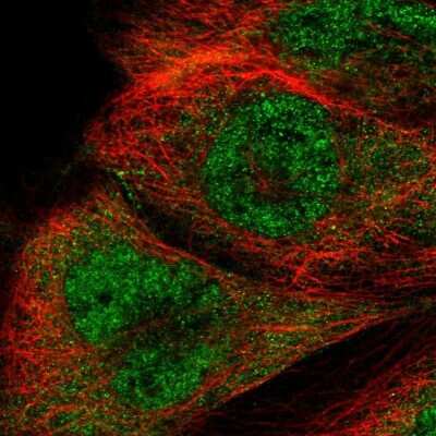 Immunocytochemistry/ Immunofluorescence: FAAP Antibody [NBP2-55137]