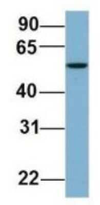 Western Blot: FAAP Antibody [NBP1-56856]