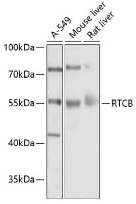 Western Blot: FAAP AntibodyBSA Free [NBP3-03596]