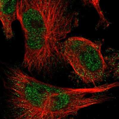 Immunocytochemistry/ Immunofluorescence: FAAP100 Antibody [NBP1-90468]