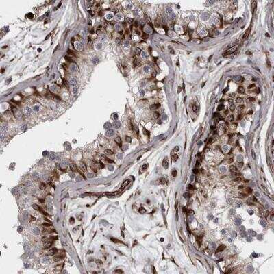 Immunohistochemistry-Paraffin: FAAP100 Antibody [NBP1-90469]