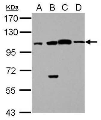 Western Blot: FAAP100 Antibody [NBP2-15635]