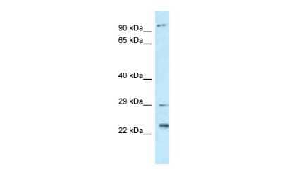 Western Blot: FAAP100 Antibody [NBP2-87388]