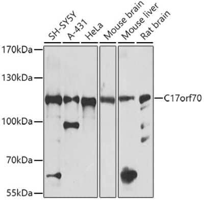 Western Blot: FAAP100 AntibodyBSA Free [NBP3-03782]