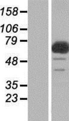 Western Blot: FAAP100 Overexpression Lysate [NBP2-06233]