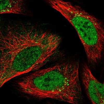 Immunocytochemistry/ Immunofluorescence: FAAP24 Antibody [NBP1-91876]