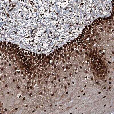 Immunohistochemistry-Paraffin: FAAP24 Antibody [NBP1-91876]