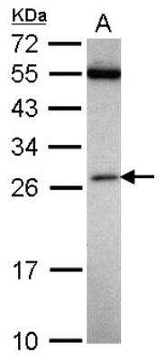 Western Blot: FAAP24 Antibody [NBP2-16398]