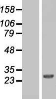 Western Blot: FAAP24 Overexpression Lysate [NBL1-08271]