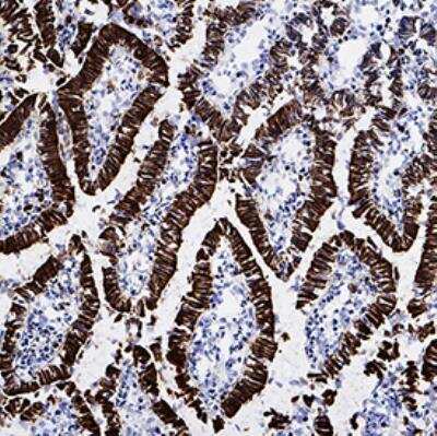 Immunohistochemistry-Frozen: FABP1/L-FABP Antibody (966927) [MAB15651]