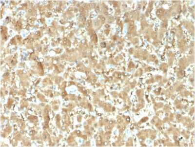 Immunohistochemistry-Paraffin: FABP1/L-FABP Antibody (FABP1/3482) [NBP3-07189]
