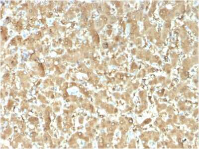 Immunohistochemistry-Paraffin: FABP1/L-FABP Antibody (FABP1/3482) - Azide and BSA Free [NBP3-08934]