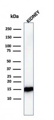 Western Blot: FABP1/L-FABP Antibody (FABP1/3482) [NBP3-07189]