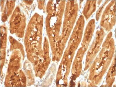 Immunohistochemistry-Paraffin: FABP1/L-FABP Antibody (FABP1/3487) [NBP3-07204]