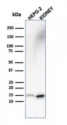 Western Blot: FABP1/L-FABP Antibody (FABP1/3487) [NBP3-07204]