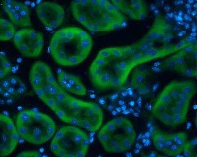 Immunohistochemistry-Frozen: FABP1/L-FABP Antibody [NBP1-32721]