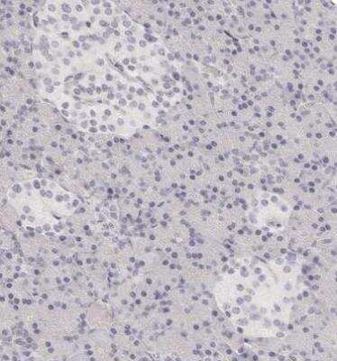 Immunohistochemistry-Paraffin: FABP1/L-FABP Antibody [NBP1-87695]