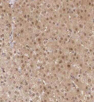 Immunohistochemistry-Paraffin: FABP1/L-FABP Antibody [NBP1-87695]