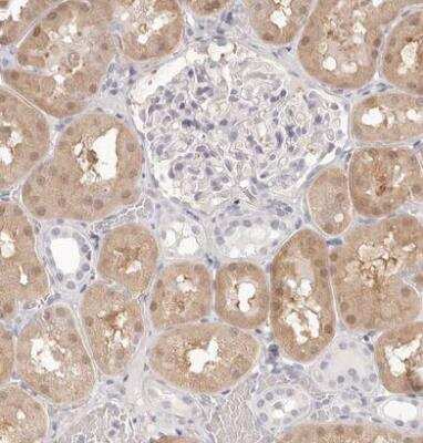 Immunohistochemistry-Paraffin: FABP1/L-FABP Antibody [NBP1-87695]