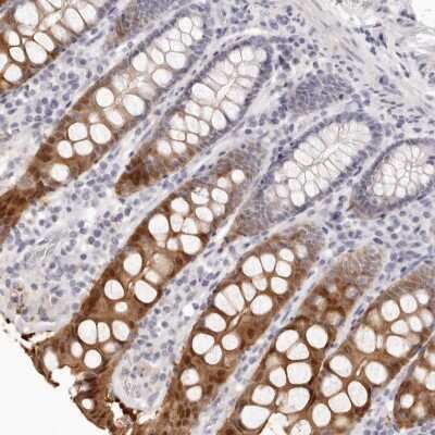 Immunohistochemistry-Paraffin: FABP1/L-FABP Antibody [NBP1-87695]