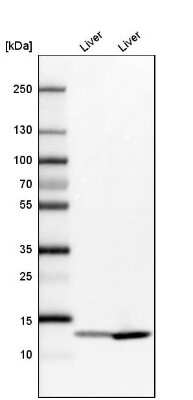 Western Blot: FABP1/L-FABP Antibody [NBP1-87695]