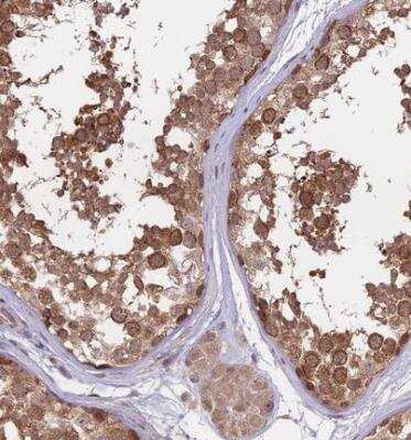 Immunohistochemistry-Paraffin: FABP12 Antibody [NBP1-93537]