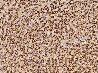 Immunohistochemistry-Paraffin: FABP12 Antibody [NBP2-98167]