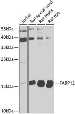 Western Blot: FABP12 AntibodyBSA Free [NBP3-04448]