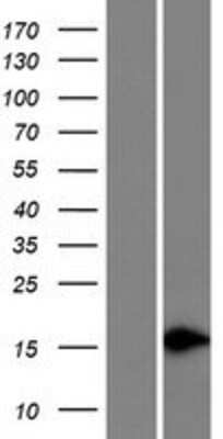 Western Blot: FABP12 Overexpression Lysate [NBP2-09356]