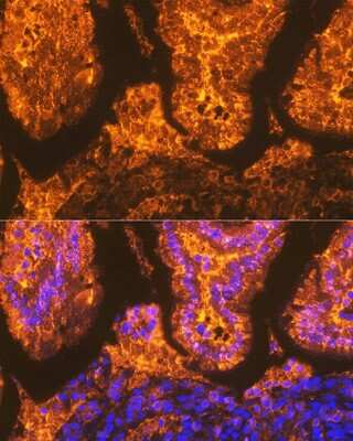 Immunohistochemistry: FABP2/I-FABP Antibody (5W9L6) [NBP3-16717]