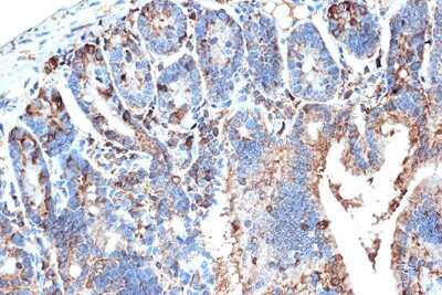 Immunohistochemistry-Paraffin: FABP2/I-FABP Antibody (5W9L6) [NBP3-16717]