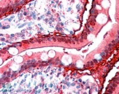 Immunohistochemistry-Paraffin: FABP2/I-FABP Antibody [NB100-59746]