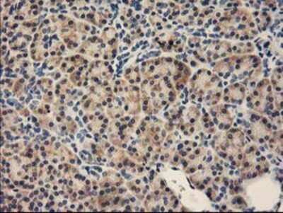 Immunohistochemistry: FABP2/I-FABP Antibody (OTI2C4) - Azide and BSA Free [NBP2-70699]