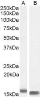 Western Blot: FABP2/I-FABP Antibody [NB100-59746]